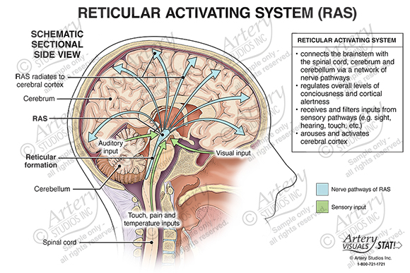 Reticular Activating System (RAS) – Schematic Sectional Side View – Artery Studios – Medical-Legal Visuals